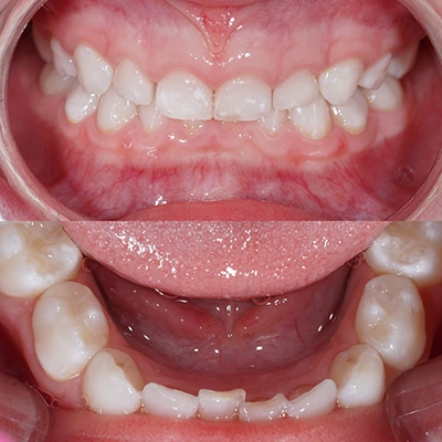 Lekarz leczący zęby dziewczynki