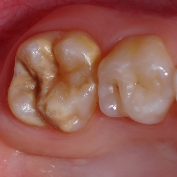 Lekarz leczy zęby dziewczynki
